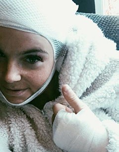 Anne Meulendijks recovering at home from the head injury she sustained in the stable