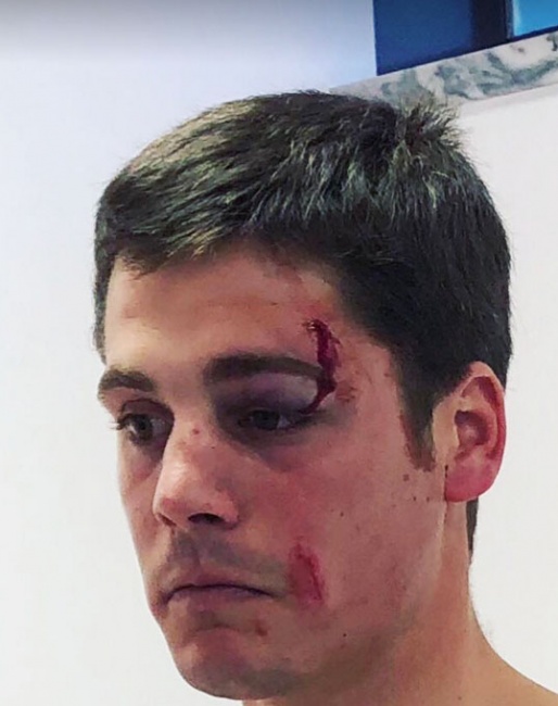 Vasco Mira Godinho after the assault in Estoril