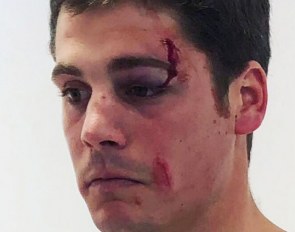 Vasco Mira Godinho after the assault in Estoril