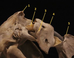 1. Nuchal crest, 2. Occipital condyle, 3. Wing of Atlas, 4. Atlas (C1), 5. Axis (C2)