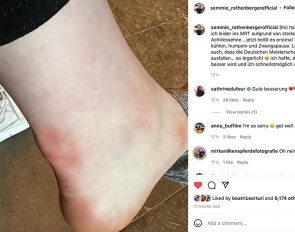 Semmieke Rothenberger's injured achilles tendon