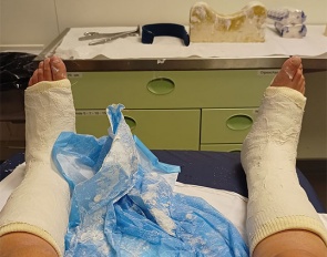 Nicole Den Dulk fractures both shin bones in a riding accident at the 2023 CPEDI Waregem