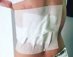 Morgan Barbançon sustains 3rd degree burns in a riding accident at the 2016 CDI Mallorca