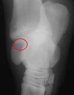 This is an example of how an OCD fragment typically looks on a radiograph.  The OCD fragment seems to “float” within a defect in the main bone