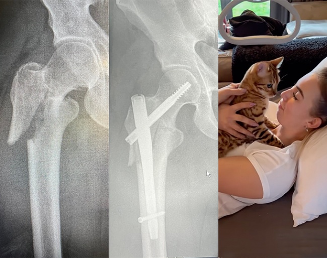 Bad luck for Stephanie Kooijman. She fractured her right hip in a fall off a horse on 12 March 2022