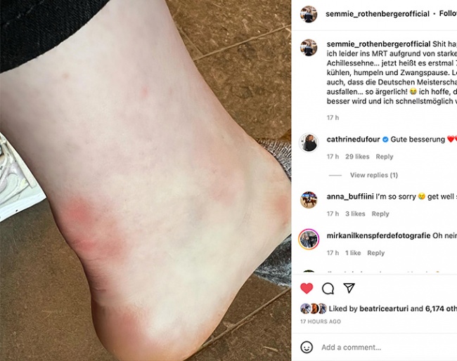 Semmieke Rothenberger's injured achilles tendon