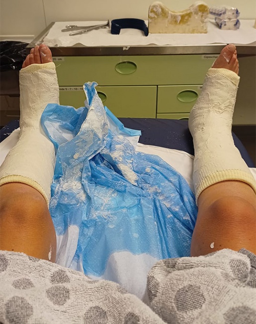 Nicole Den Dulk fractures both shin bones in a riding accident at the 2023 CPEDI Waregem