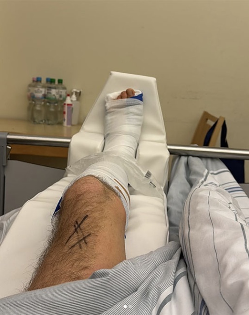 William Matthew fractured his ankle